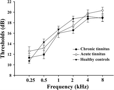 Cerebral Blood Flow Difference Between Acute and Chronic Tinnitus Perception: A Perfusion Functional Magnetic Resonance Imaging Study